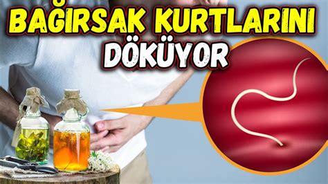  Tetrabothrius! Bu Parazit Solucanı Tanıyor musunuz: Bağırsakların Gizli Yoldaşı