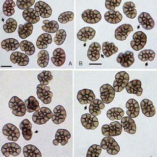  Xenosporium!  A Masterpiece of Microscopic Architecture and an Epitome of Ciliary Prowess